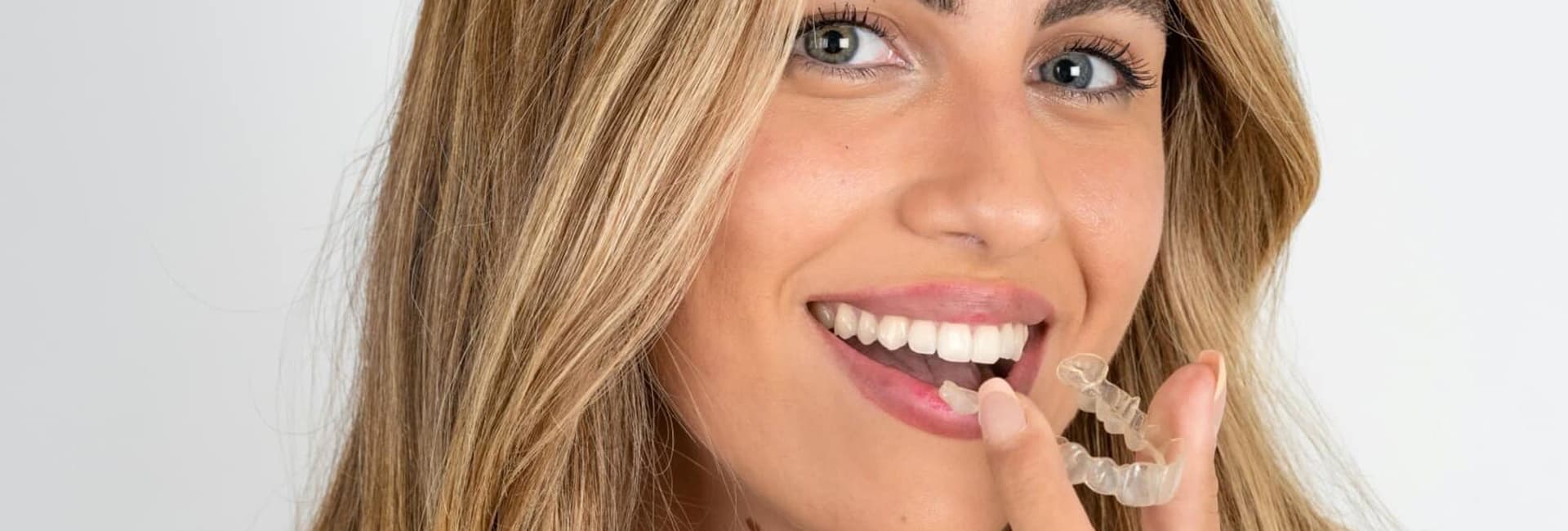 Invisalign and orthodontics in Calgary